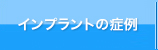 インプラントの症例